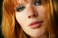 Lynette - Freckled